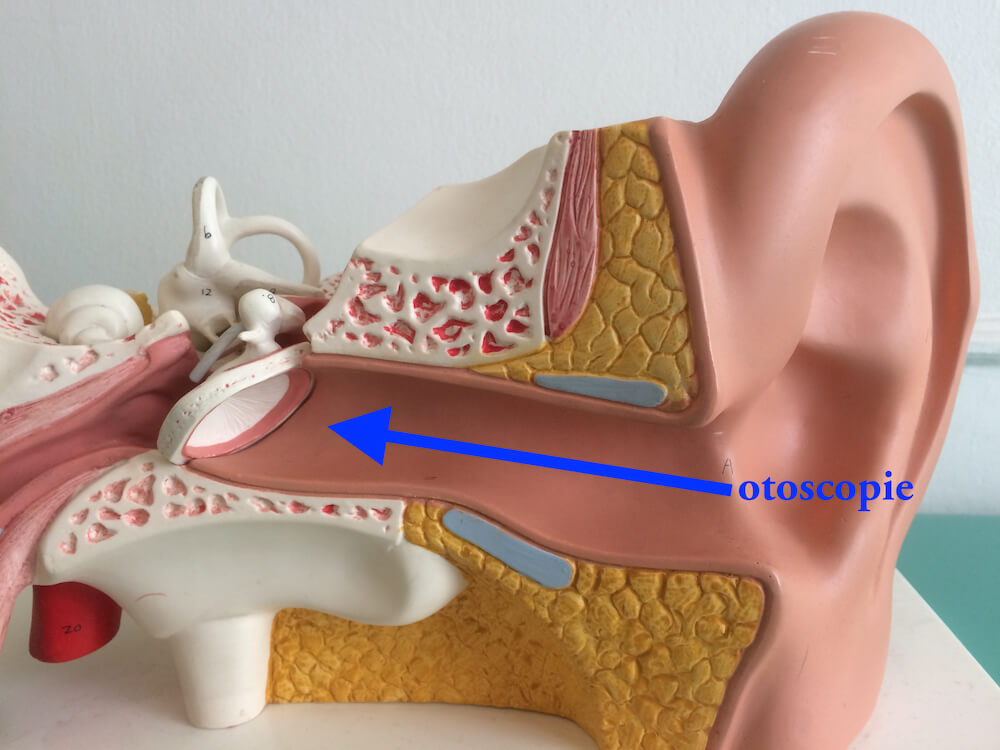 Endoscopie de l'oreille. ORL médecin examinant l'oreille de l'homme mature  à l'aide d'un endoscope à la clinique d'otolaryngologie Photo Stock - Alamy
